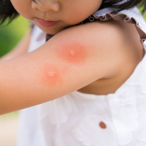 prévention naturelle moustique